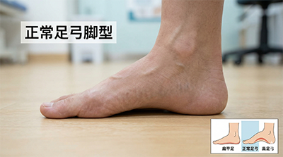 正常足弓脚型图
